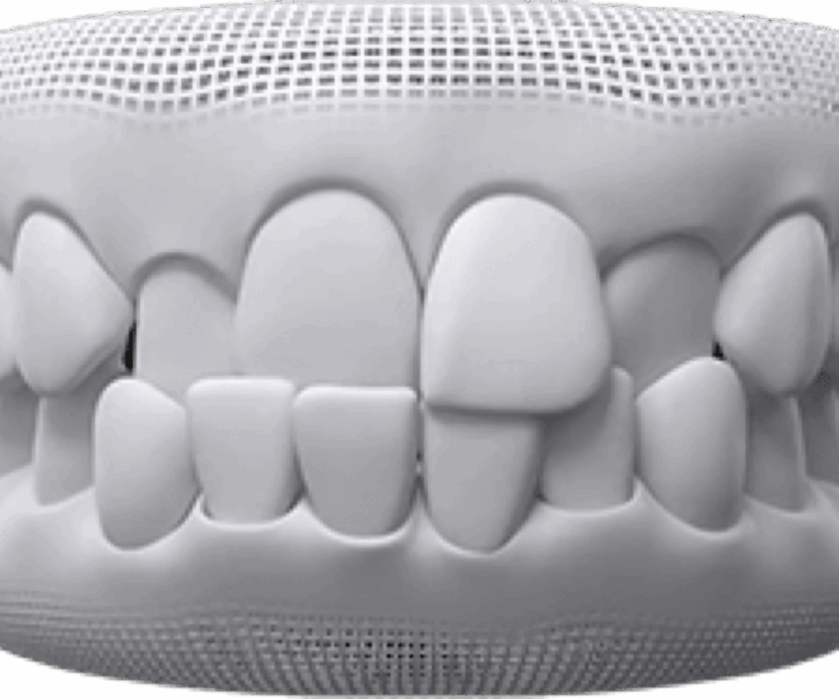 Crossbite